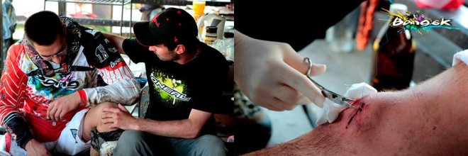 pavol kičin úraz - ružomberok